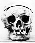 20-Beethoven_Skull.jpg